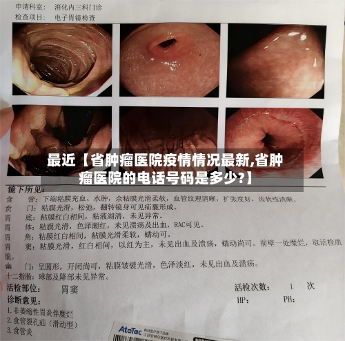 最近【省肿瘤医院疫情情况最新,省肿瘤医院的电话号码是多少?】
